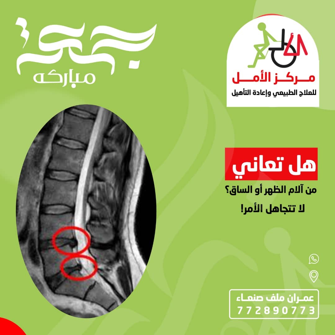 العلاج الطبيعي 3